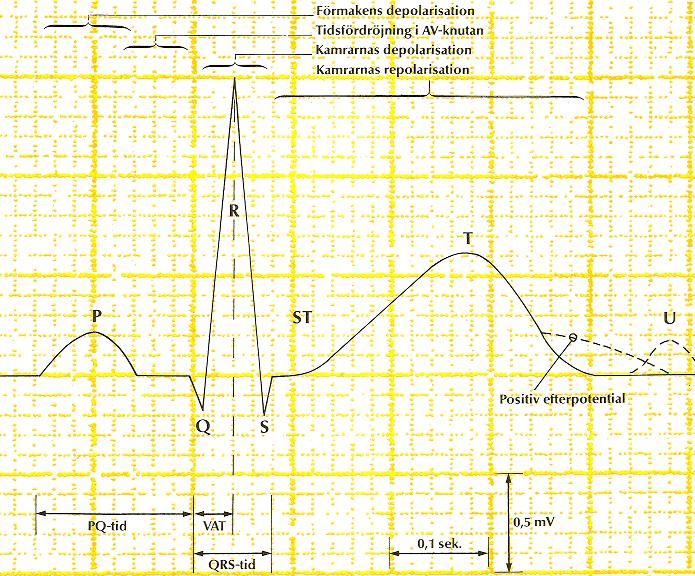 EKG-definitioner