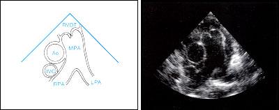 Pulmonalis